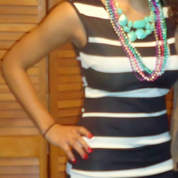 striped akira dress - Picture 2 of 3